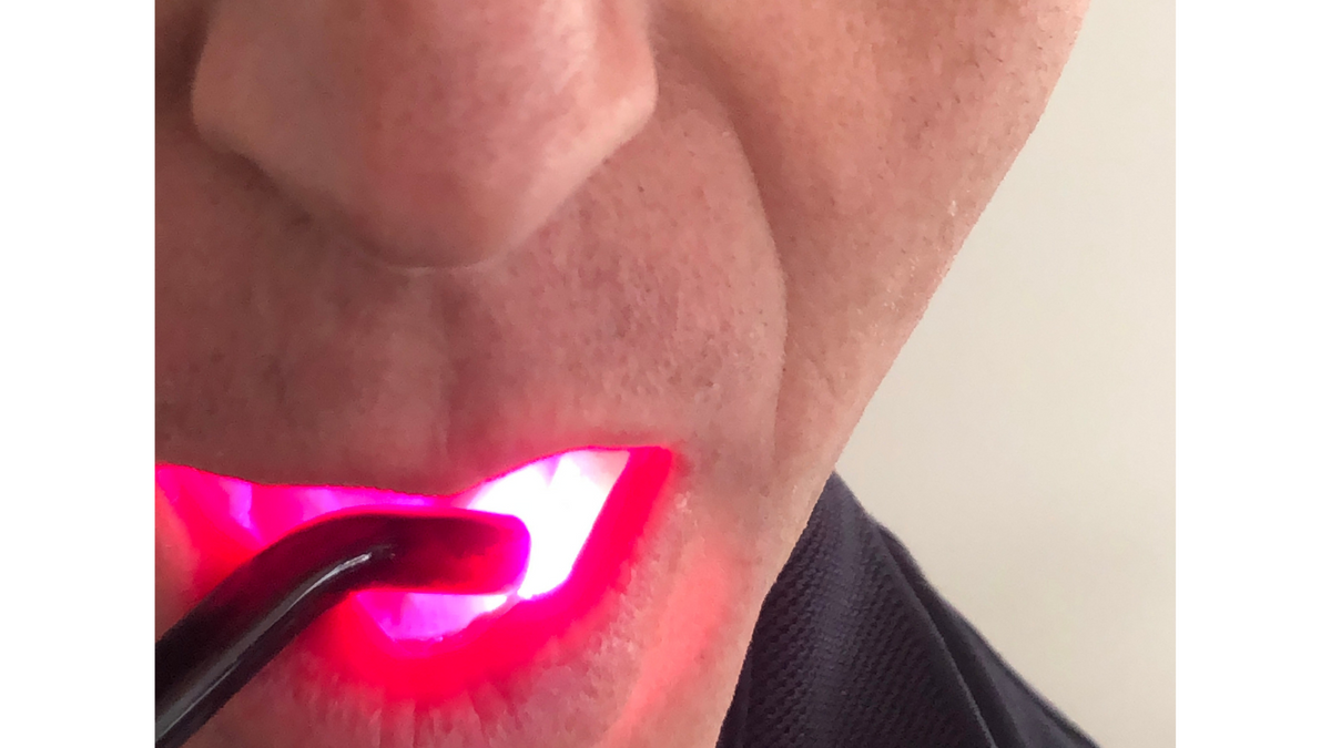 NEW Total Tooth &amp; Gum Care Bundle - WAS £413 now £333 - 72 HOURS - Oralight Pro Toothbrush, LED Mouthpieces &amp; Wonda LED Wand