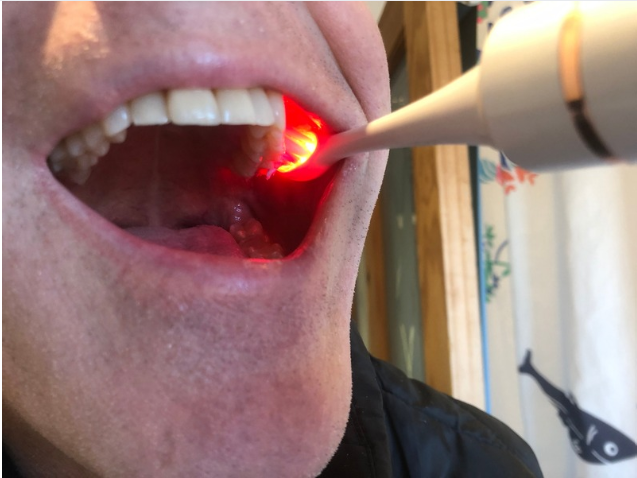 NEW Oralight Pro Toothbrush - Red Light, Near Infrared &amp; Blue Light Therapy Sonic Toothbrush - Order Now for Feb Delivery