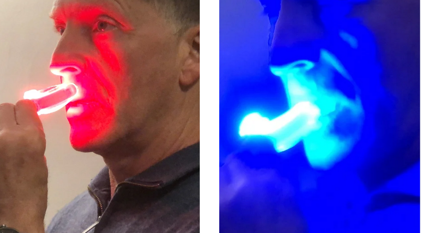 NEW Oralight Tooth &amp; Gum Care System - Red &amp; Blue Periodontal Light Therapy - Order Now for Feb Delivery